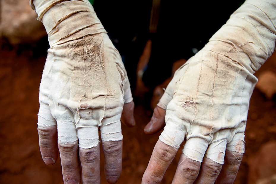 A climber displays their worn tape gloves. [Photo] Andrew Burr