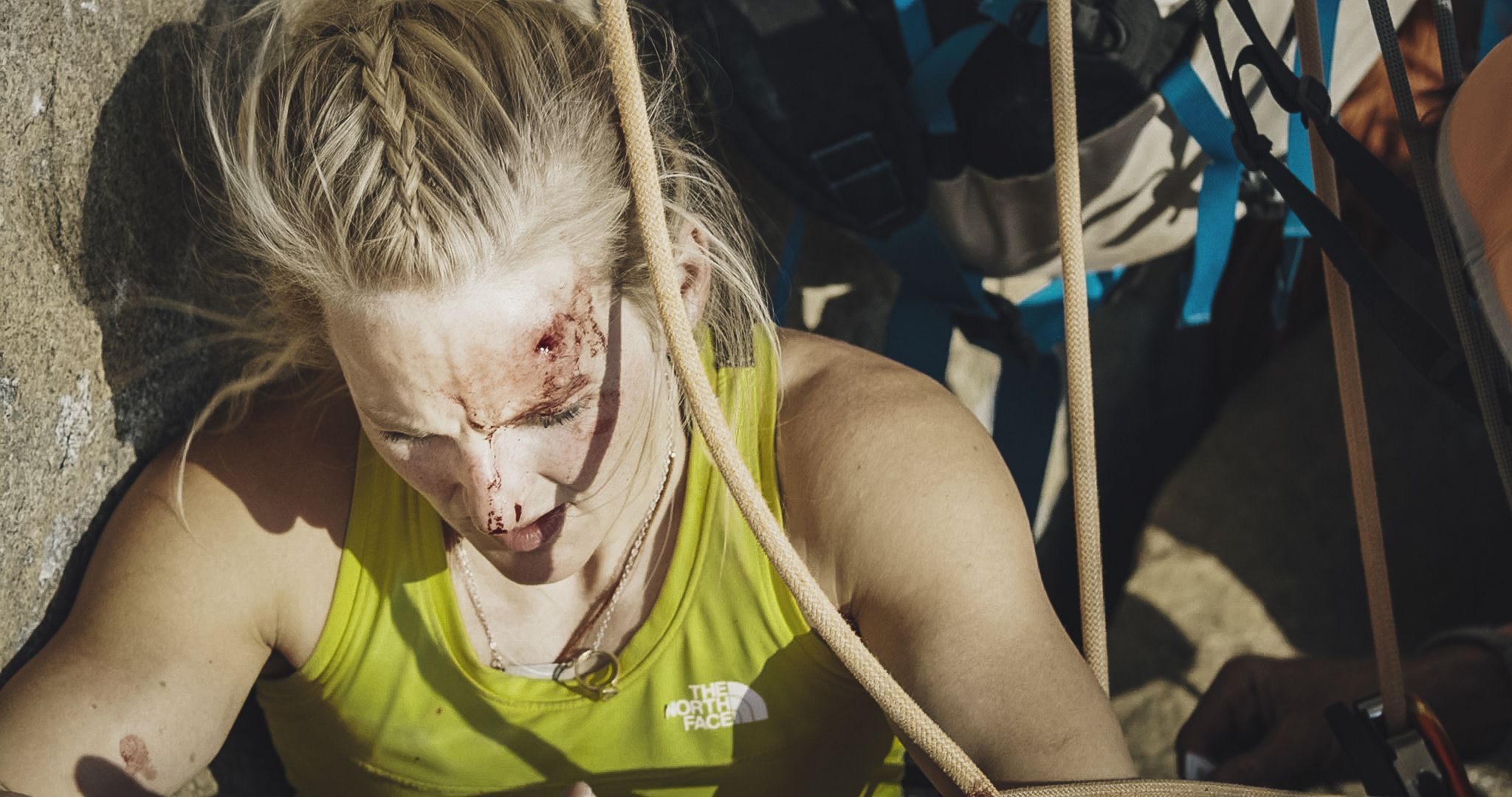 Harrington recovering from the fall on the Golden Desert pitch that left her bloodied. [Photo] Jon Glassberg, Louder Than 11
